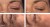 Mesoestetic-Global-Eyecon.jpg