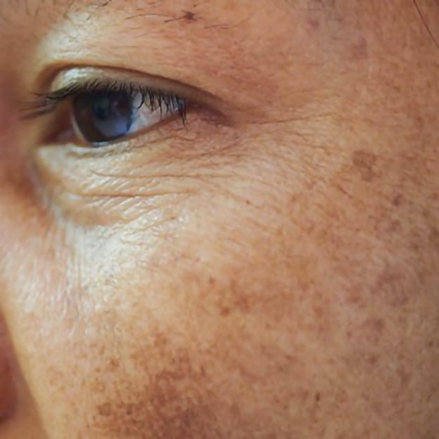 SRS TXA Bright 3ml - termin ważności 30/06/2026